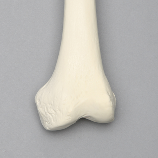 Femur, 9.5 mm Canal, Solid Foam, Left, Small