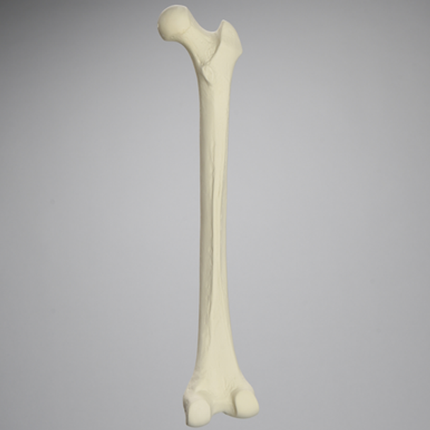 Femur, 15 mm Canal, Solid Foam, Right, Medium