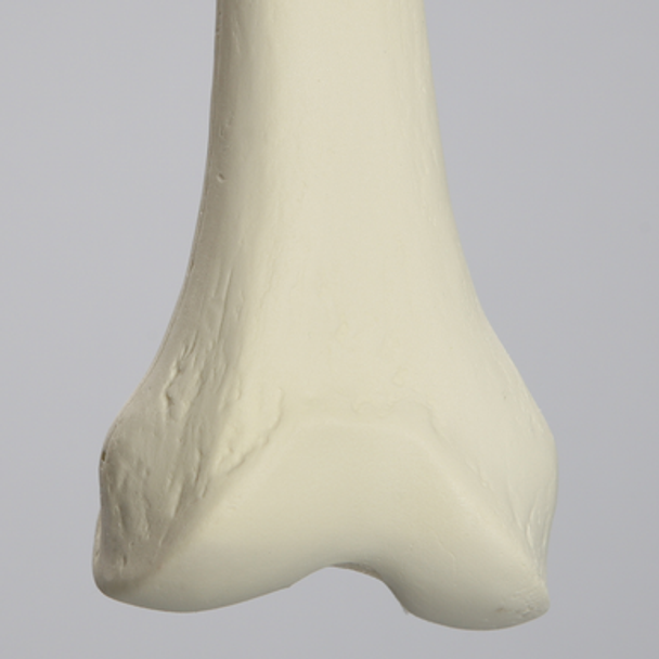 Femur, 15 mm Canal, Solid Foam, Right, Medium