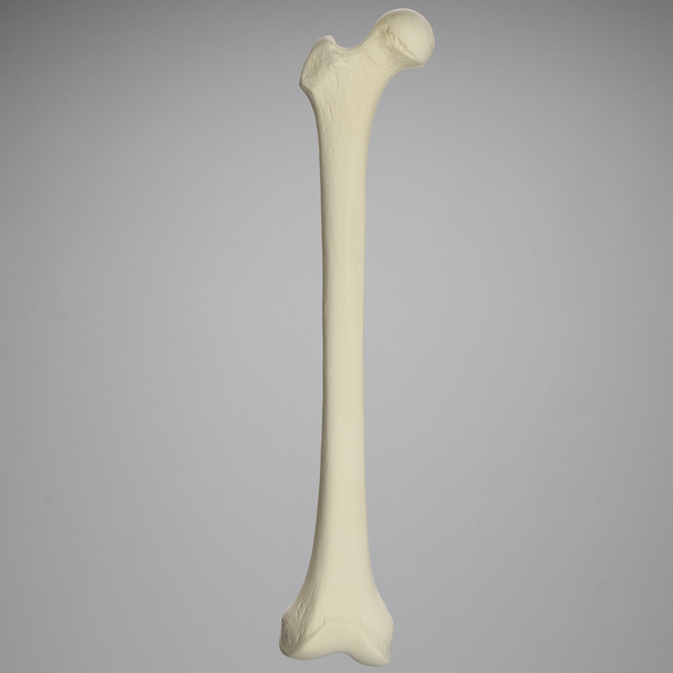 Femur, 15 mm Canal, Solid Foam, Right, Medium