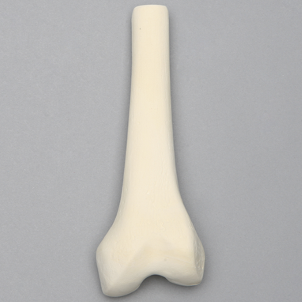 Femur, Distal with 15 mm Canal, Left