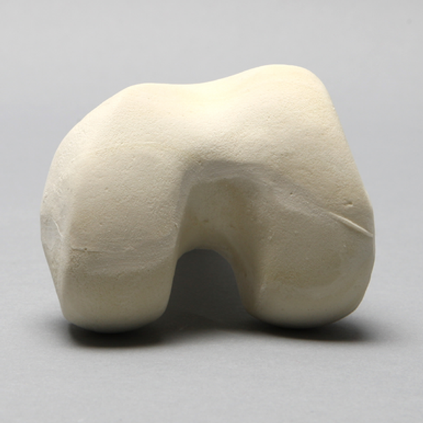 Femur, Distal with 15 mm Canal, Left