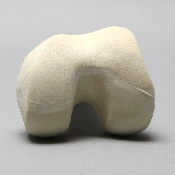 Femur, Distal with 15 mm Canal, Left