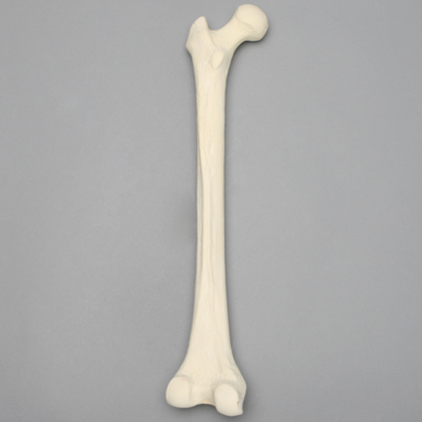 Femur, 15 mm Canal, Solid Foam, Left, Medium
