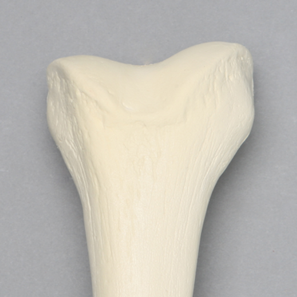 Femur, 15 mm Canal, Solid Foam, Left, Medium