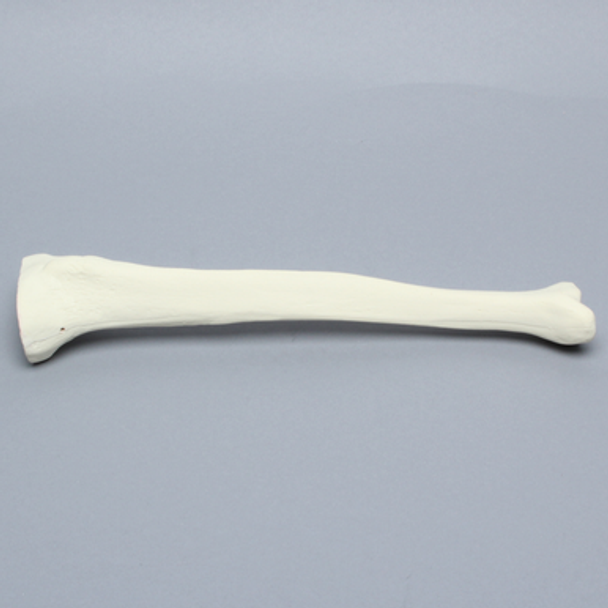 Tibia Proximal Resection, Foam Cortical, Left, Medium
