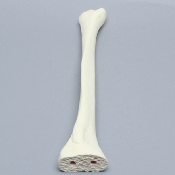 Tibia Proximal Resection, Foam Cortical, Left, Medium