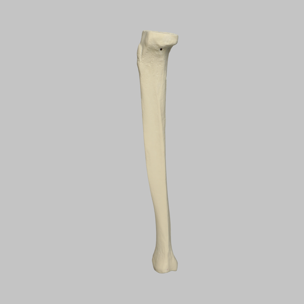 Tibia Proximal Resection, Foam Cortical, Left, Medium