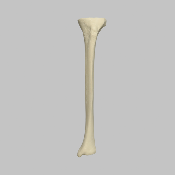 Tibia Proximal Resection, Foam Cortical, Left, Medium