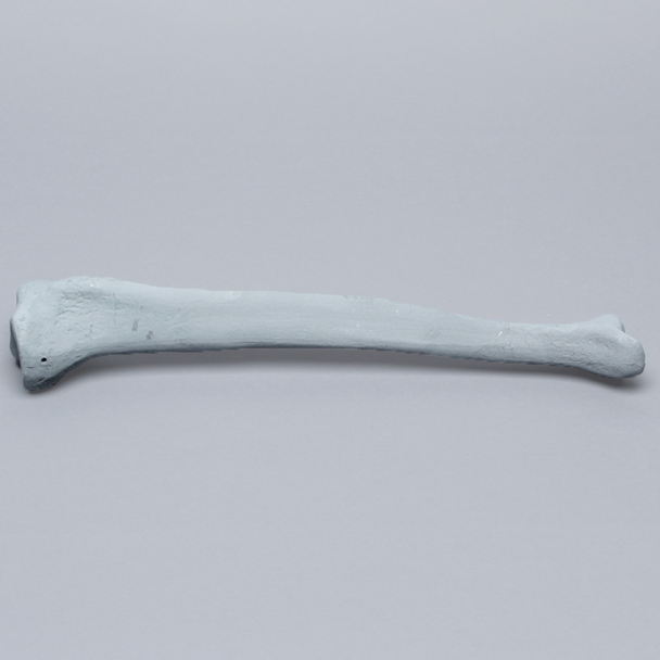 Tibia with Plugged Distal End and Radiopaque Properties, Left