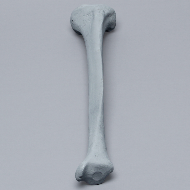 Tibia with Plugged Distal End and Radiopaque Properties, Left