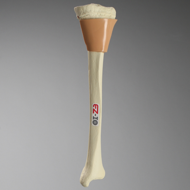 Tibia with Skin Patch, Pediatric