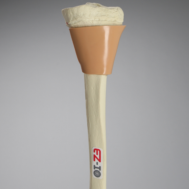 Tibia with Skin Patch, Pediatric