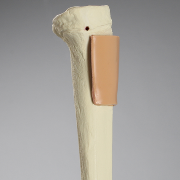 Tibia with Skin Patch, Pediatric