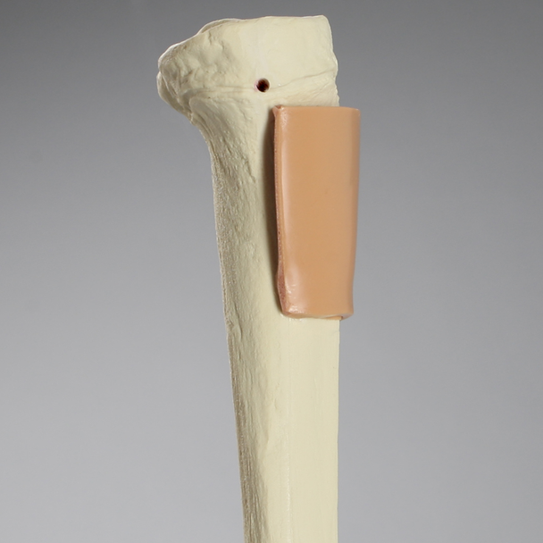 Tibia with Skin Patch, Pediatric