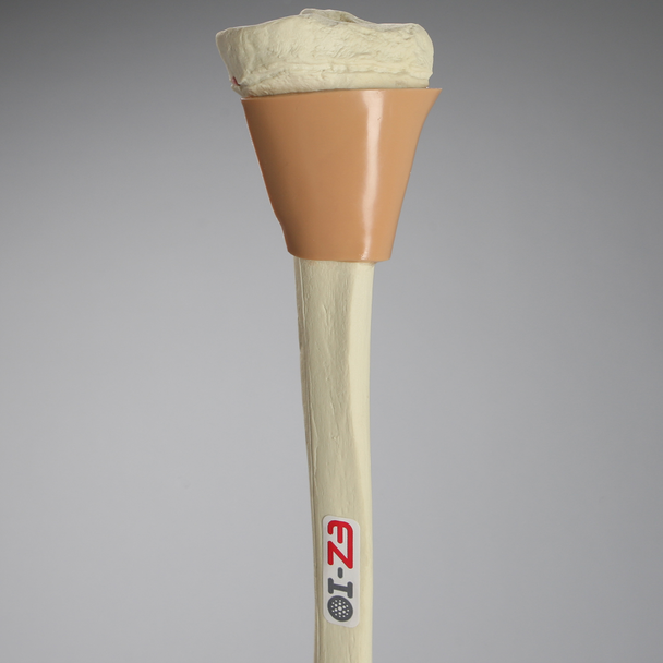 Tibia with Skin Patch, Pediatric