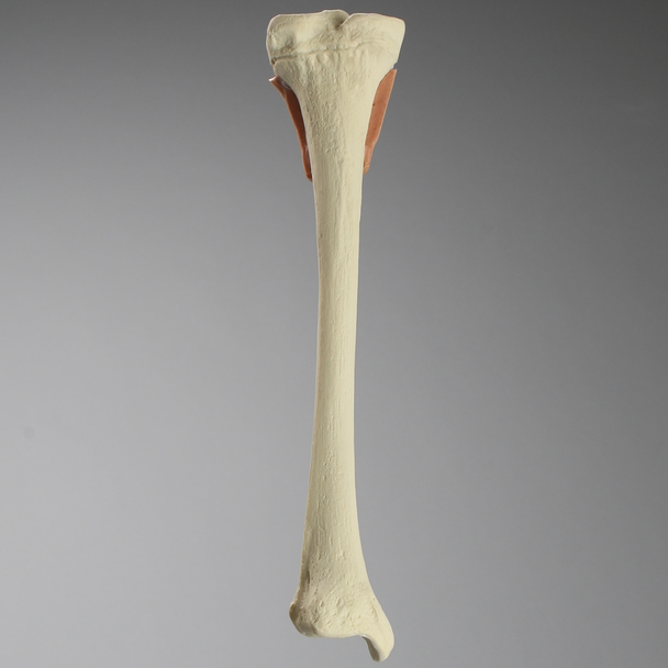 Tibia with Skin Patch, Pediatric