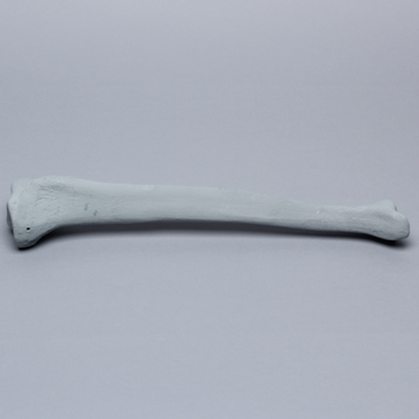 Tibia with Radiopaque Properties, Left, Medium