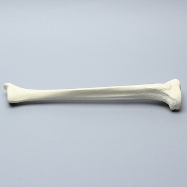 Tibia, High Density, Left, Medium