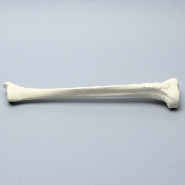 Tibia, High Density, Left, Medium