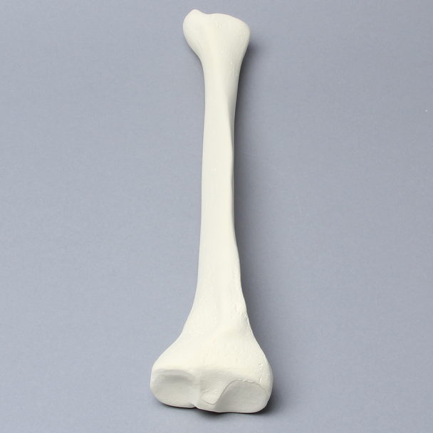 Tibia with 12.7 mm, Foam Cortical, Right, Medium