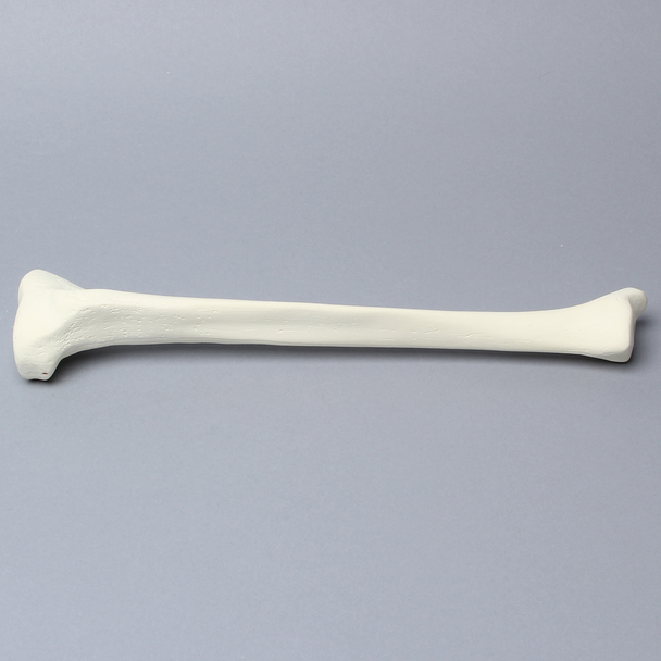 Tibia with 12.7 mm, Foam Cortical, Right, Medium