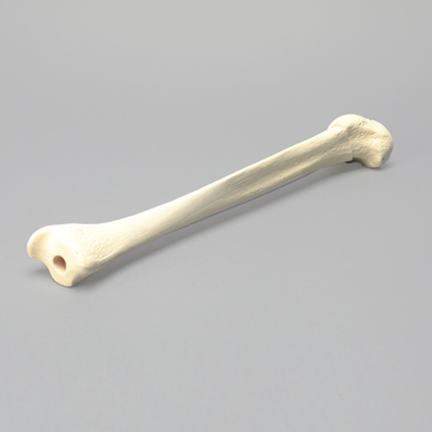 Tibia with 12 mm Canal, Oblique Fracture for IM Nail