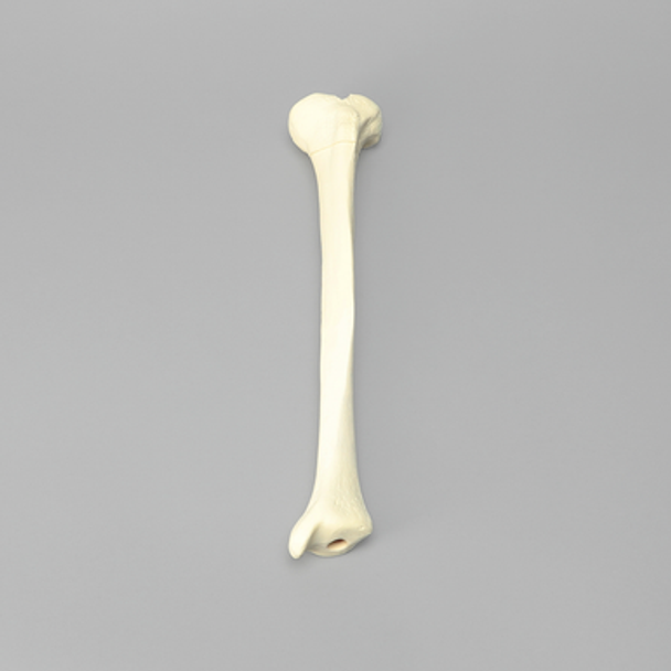 Tibia with 12 mm Canal, Oblique Fracture for IM Nail