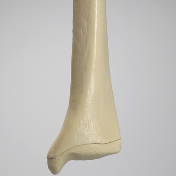Tibia with Osteoporotic Cortex, Left, Medium