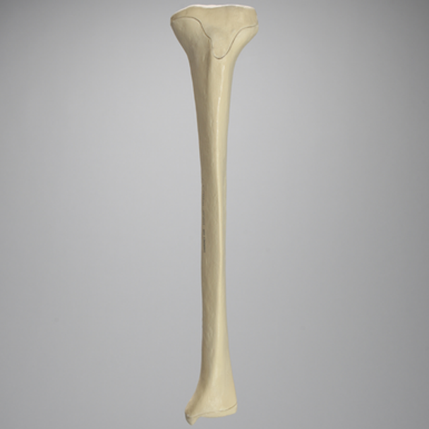 Tibia with Osteoporotic Cortex, Left, Medium