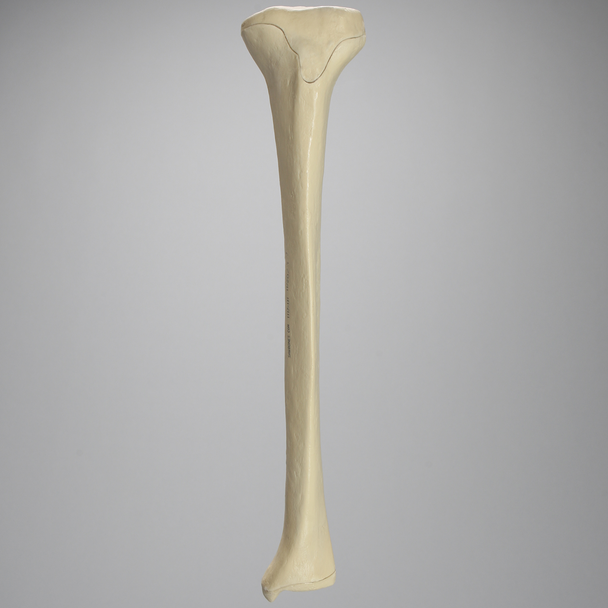 Tibia with Osteoporotic Cortex, Left, Medium