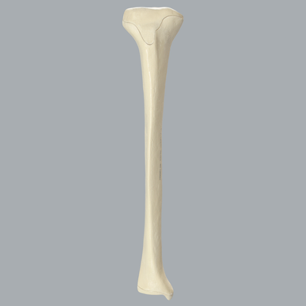 Tibia with Osteoporotic Cortex, Right, Medium