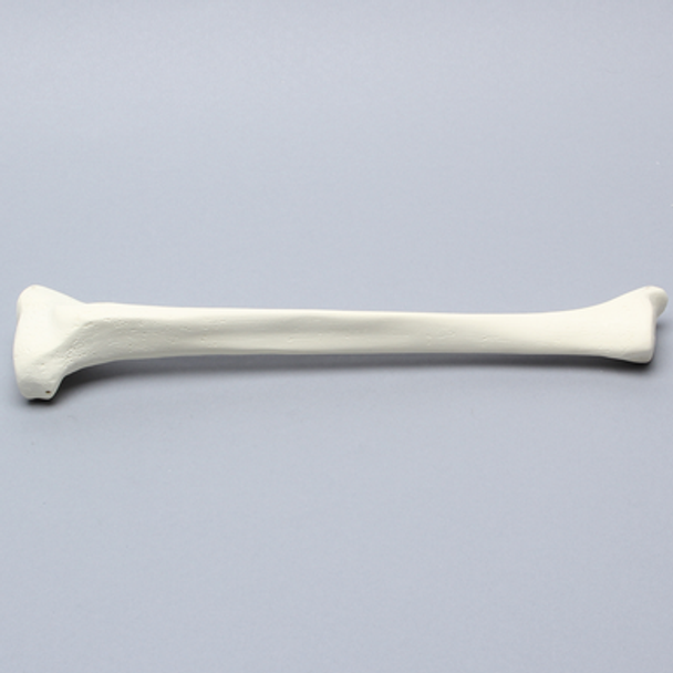 Tibia with 12.7 mm Canal, Solid Foam, Right, Medium