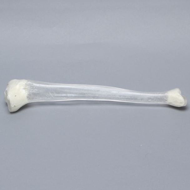 Tibia with 13 mm Canal, Transparent, Left, Medium