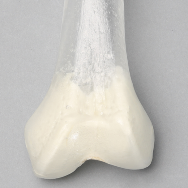 Femur, Transparent with 14 mm Canal, Left