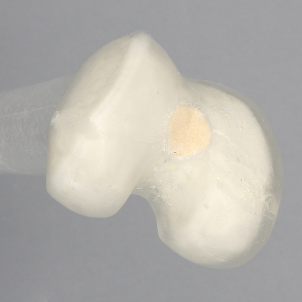 Femur, Transparent with 15.5 mm Canal, Right