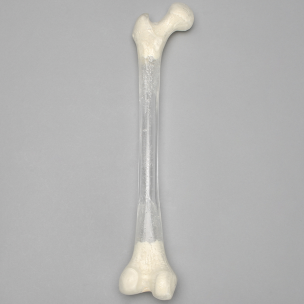 Femur, Transparent with 15.5mm Canal, Left