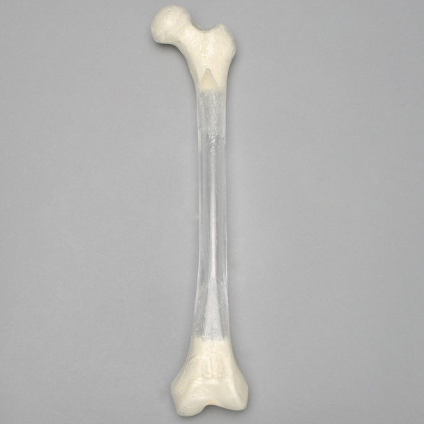 Femur, Transparent with 15.5mm Canal, Left
