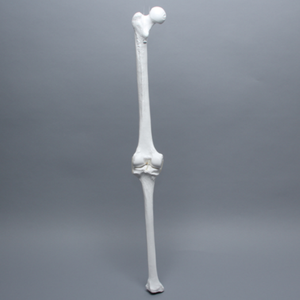 Full Length Knee with Patella and Three Stretch Cord Ligaments
