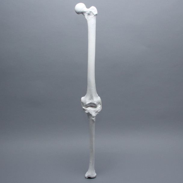 Full Length Knee with Three Stretch Cord Ligaments, Left, Large