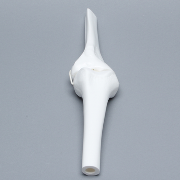 Knee Joint with Four Stretch Cord Ligaments