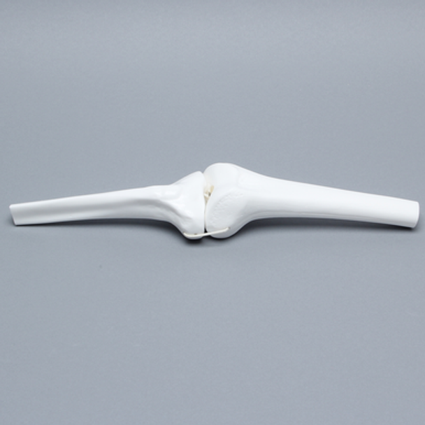 Knee Joint with Four Stretch Cord Ligaments