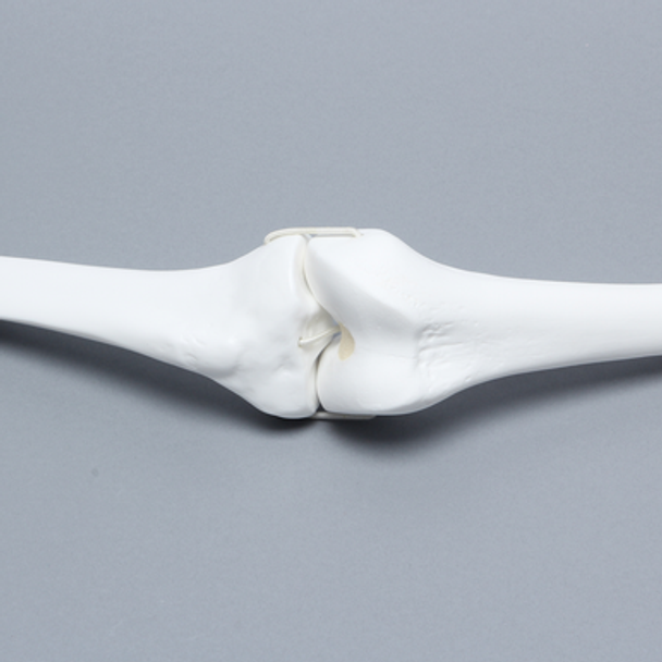 Knee Joint with Four Stretch Cord Ligaments