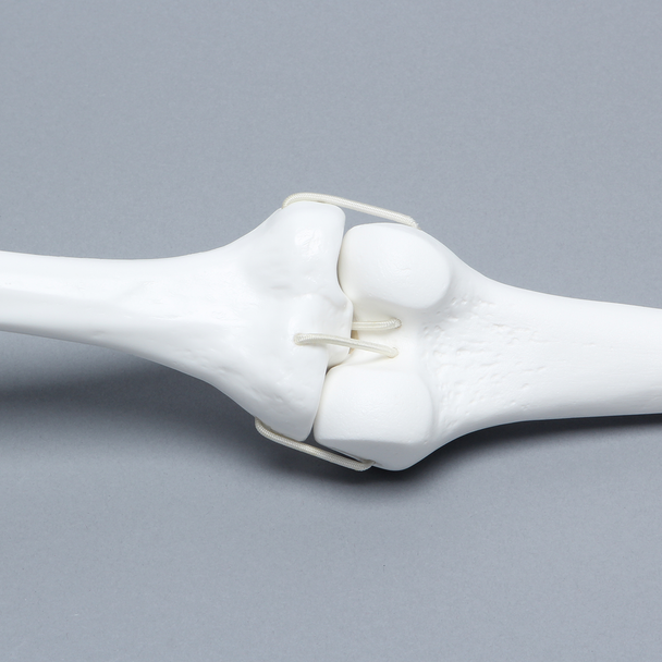 Knee Joint with Four Stretch Cord Ligaments