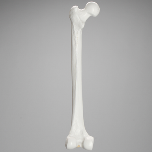Femur with 15.5 mm Canal, Plastic Cortical Shell, Large