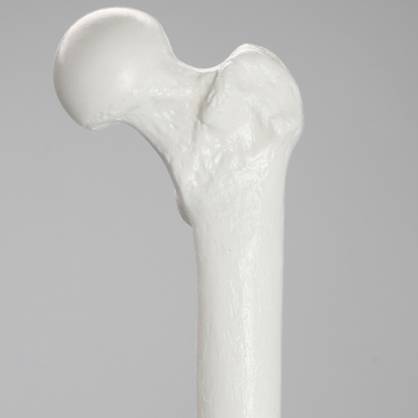 Femur with 15.5 mm Canal, Plastic Cortical Shell, Large