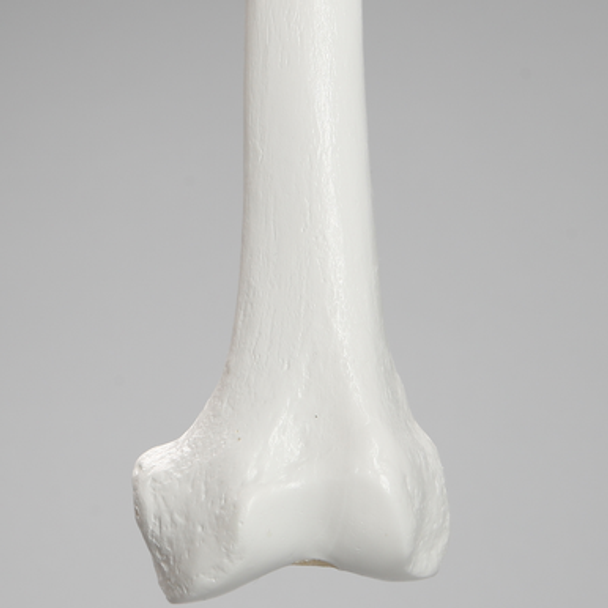 Femur with 15.5 mm Canal, Plastic Cortical Shell, Large