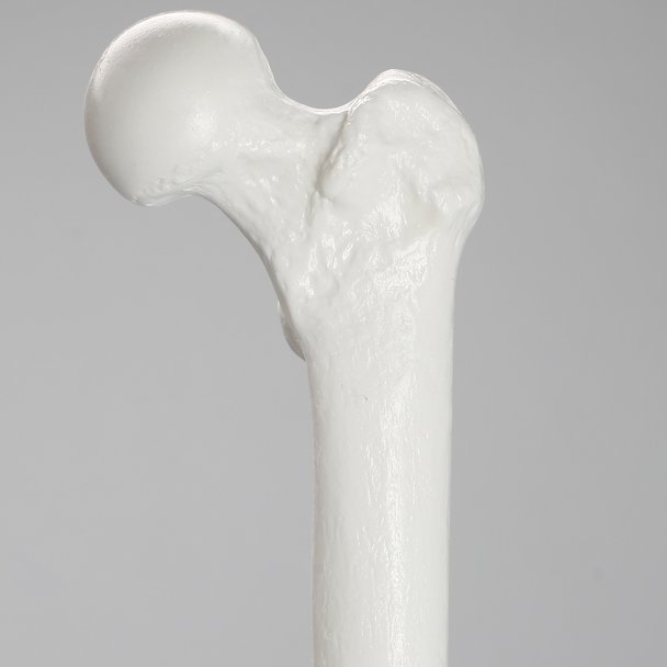 Femur with 15.5 mm Canal, Plastic Cortical Shell, Large