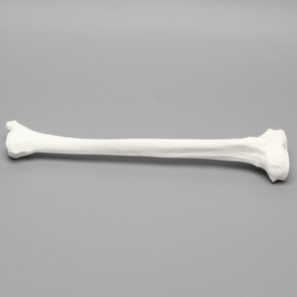 Tibia, Plastic Cortical Shell, Left