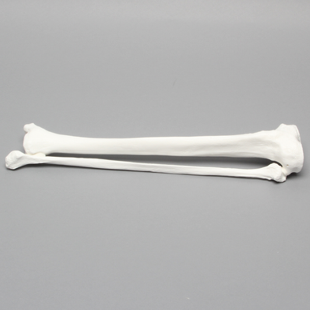Tibia and Fibula, Plastic Cortical Shell, Large